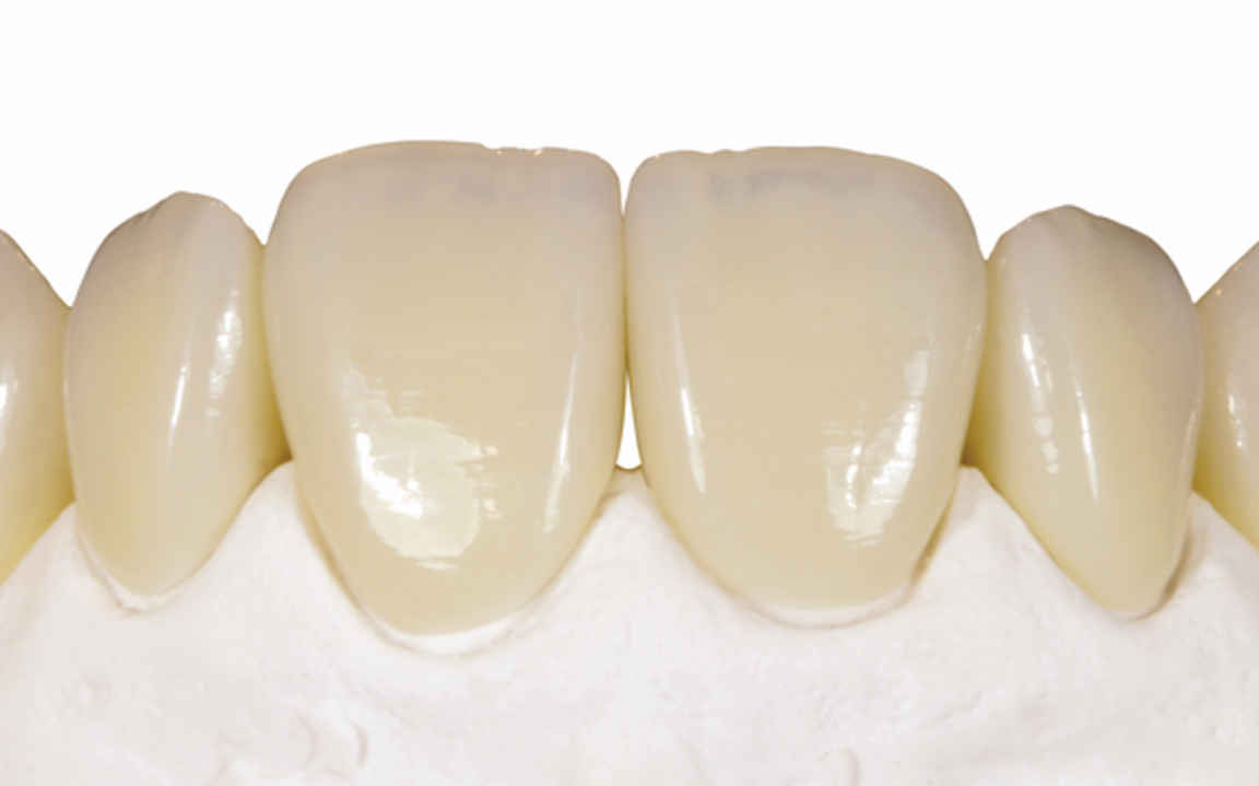 Advanced Veneers and Tooth Wear Management - 3-Day Intensive Program - Image 2